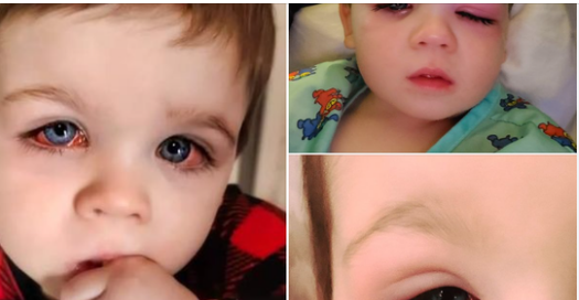 Mom issues warning after toddler nearly lost eyesight from bath toy